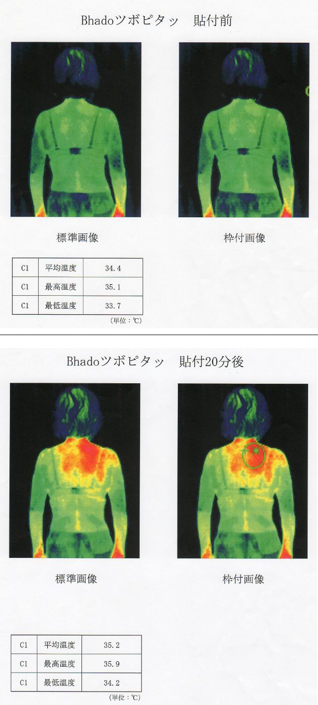 温熱